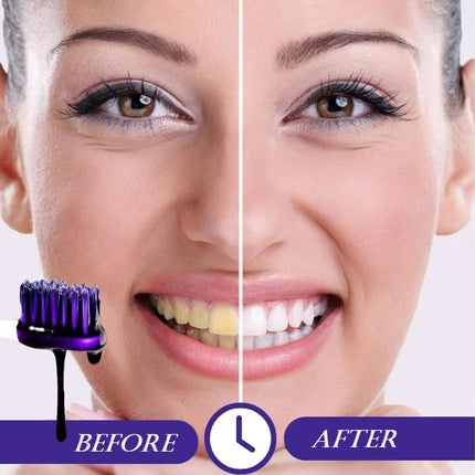 MeanSmile V34 Whitening Serum